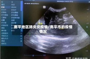 南平地区肺炎炎疫情/南平市的疫情情况